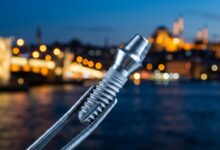 Een close-up van een glanzend titanium tandimplantaat dat wordt vastgehouden door een chirurgische pincet, met op de achtergrond een prachtig onscherp en verlicht stadsbeeld van Istanbul bij schemering.