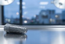 Close-up van een modern titanium tandimplantaat met op de achtergrond een onscherpe, professionele klinische omgeving en een Belgische stadsgezicht.