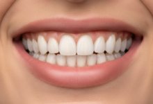 Close-up of a pristine, bright white smile with healthy, perfectly shaped teeth, indicating successful cosmetic dental work like composite bonding. The background is a soft-focus, golden-hued cityscape of Belgium with historic architecture under natural daylight.