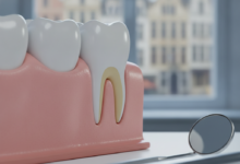 Close-up photorealistic image showing an idealized section of healthy gum tissue and a tooth, with soft clinical lighting. Blurred dental instruments are in the background, and an out-of-focus European city skyline is visible through a window, representing advanced dental care in Belgium.