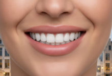 Close-up of a person smiling confidently, showcasing perfect, bright teeth, implying dental veneers. The background is softly blurred, featuring abstract European city architecture. The scene suggests dental aesthetics and financial planning in Belgium.