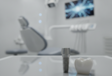 Close-up of a titanium dental implant screw and a ceramic dental crown on a clean surface. In the blurred background, a modern, high-tech dental clinic with sleek equipment is visible, emphasizing advanced medical technology.