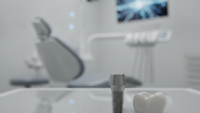 Close-up of a titanium dental implant screw and a ceramic dental crown on a clean surface. In the blurred background, a modern, high-tech dental clinic with sleek equipment is visible, emphasizing advanced medical technology.
